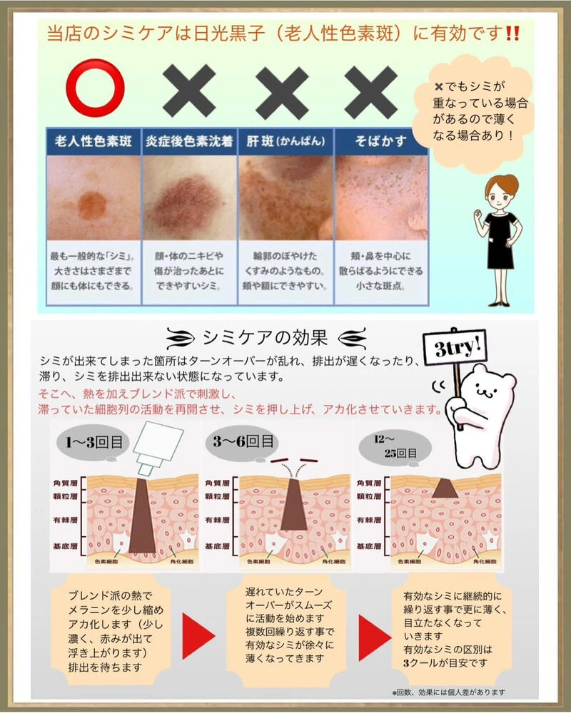 ブログ