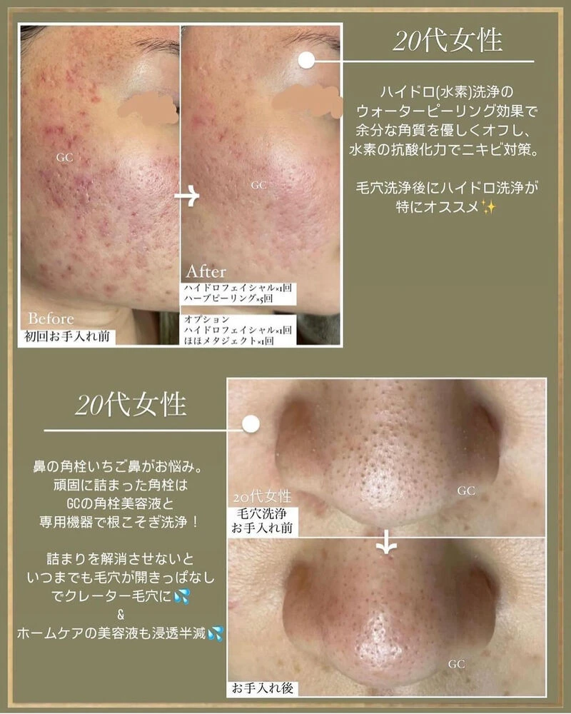 ブログ