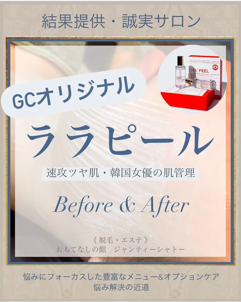 ブログ