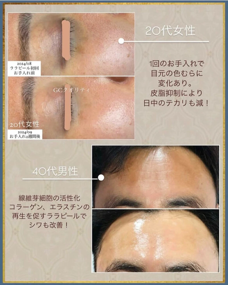 ブログ